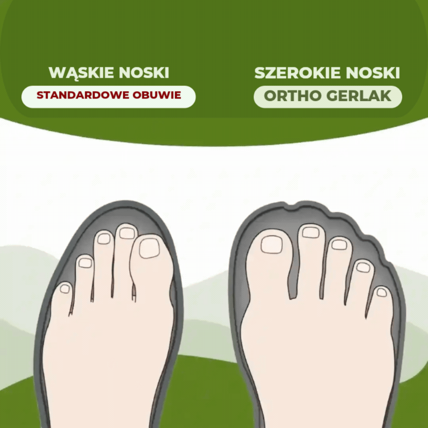 Szeroki nosek